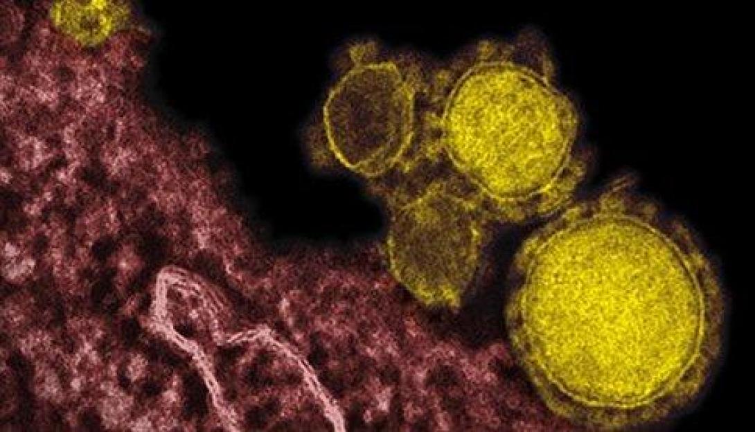 Νέο κρούσμα του κοροναϊού MERS στις ΗΠΑ
