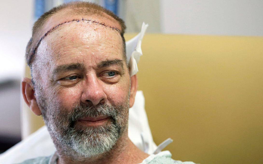 μεταμοσχευση