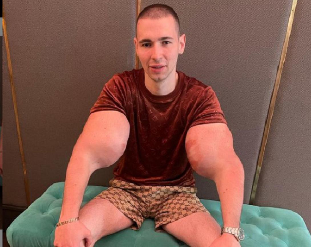 μπράτσα ποπάι