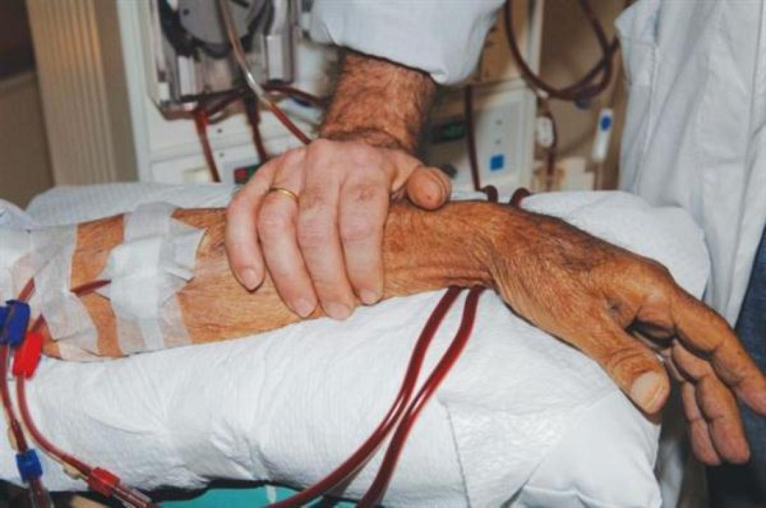 "Ακατάλληλα τα φίλτρα του τεχνητού νεφρού" καταγγέλουν οι νεφροπαθείς