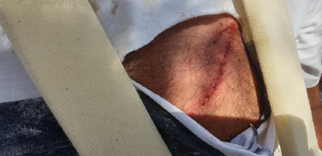 για το συμβάν έχει ενημερωθεί η Αστυνομία