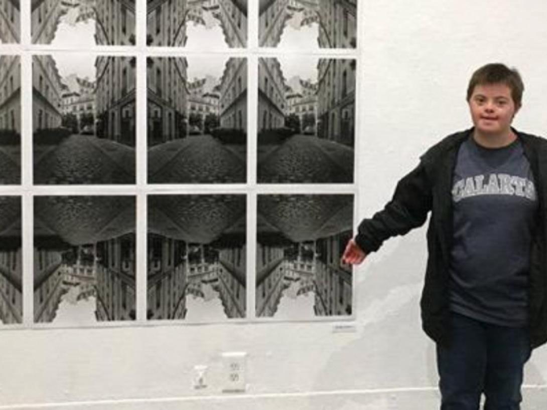 κορίτσι με σύνδρομο Down