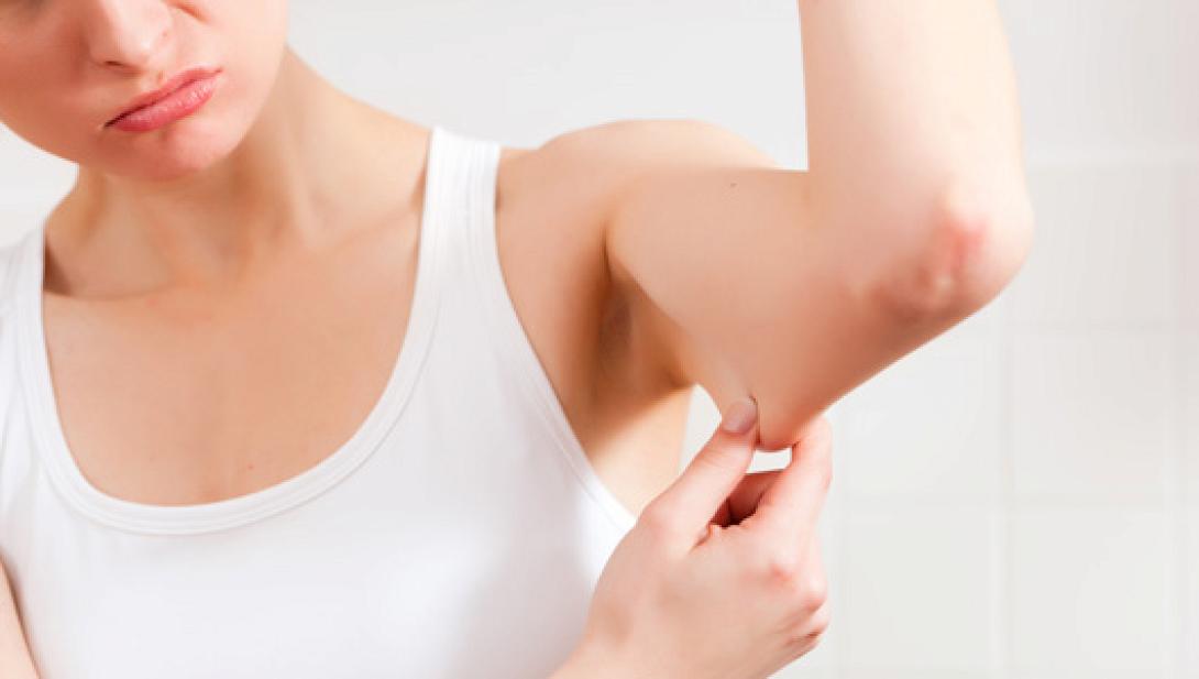 Arm lift: Άλλη μια επανάσταση στην Πλαστική Χειρουργική (από τον πλαστικό χειρουργό Ιωάννη Λιαπάκη)