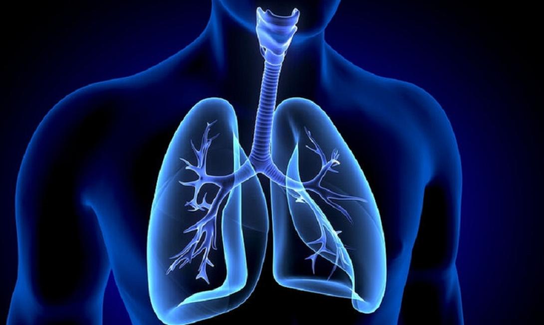 Καρκίνος πνεύμονα