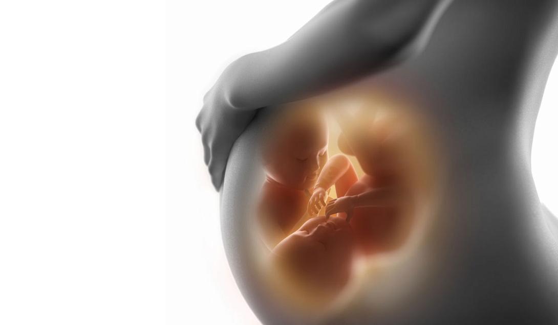 προεκλαμψία