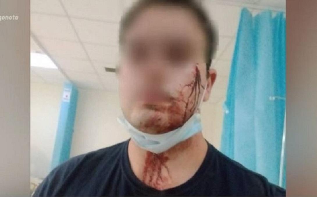 τραυματίας αστυνομικός