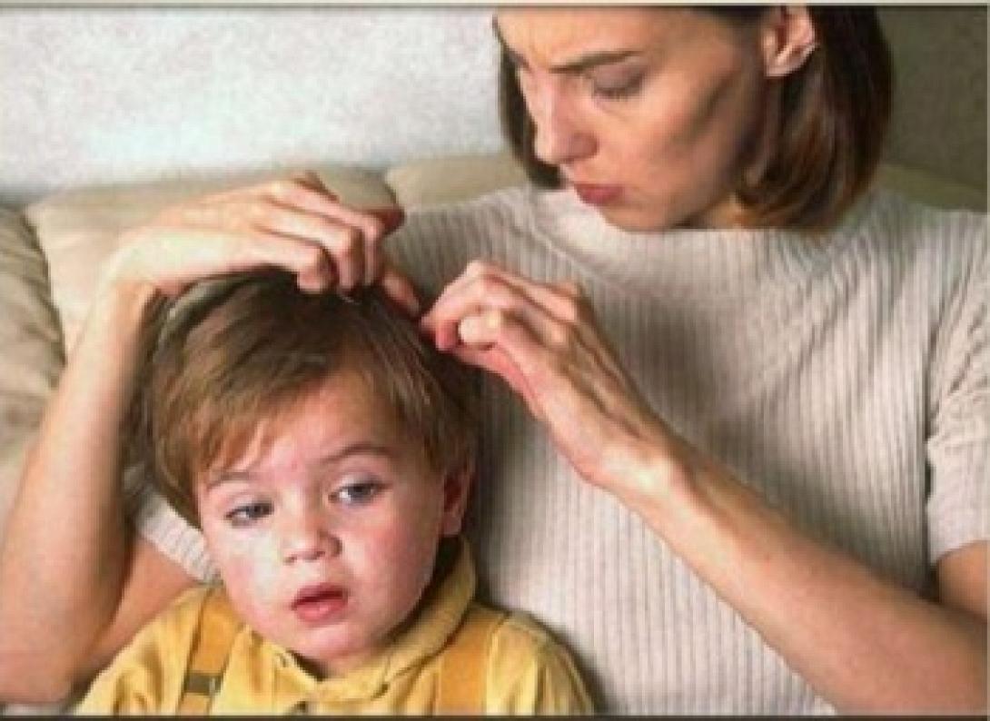 Ψείρες: πώς να τις αντιμετωπίσετε οικονομικά και αγνά