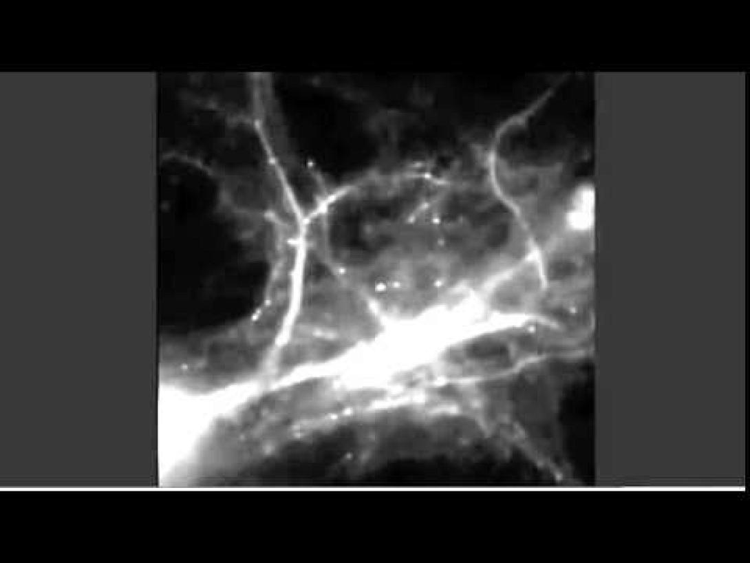 Επιστήμονες ...βιντεοσκόπησαν πως αποτυπώνεται μια ανάμνηση στον εγκέφαλο