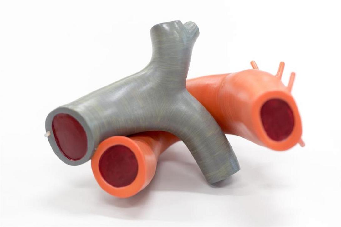 ηλεκτρονικά αιμοφόρα αγγεία