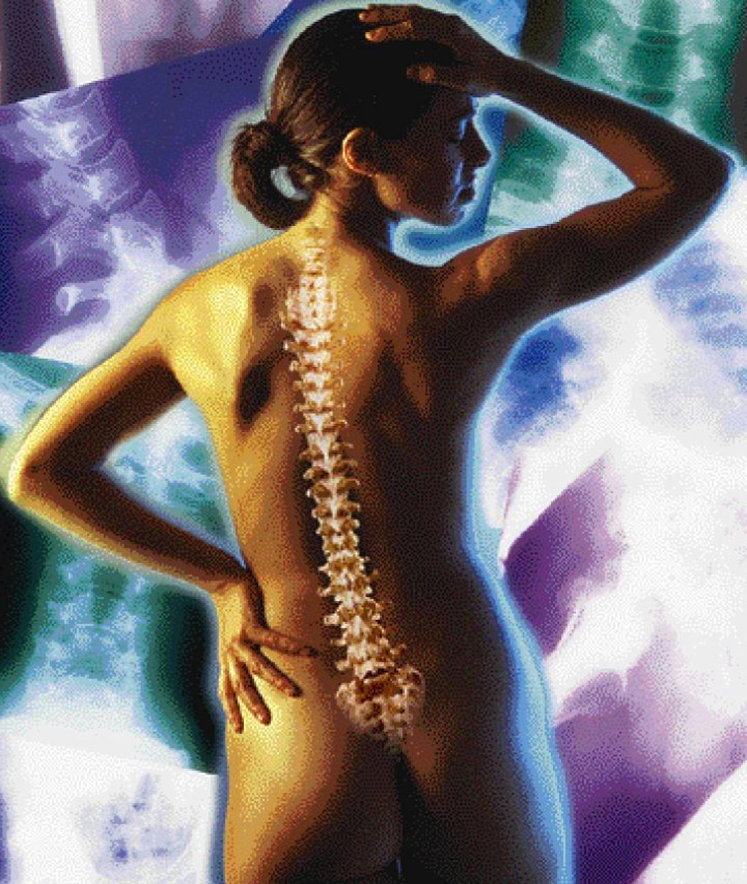 Σκολίωση και μέθοδοι αντιμετώπισης