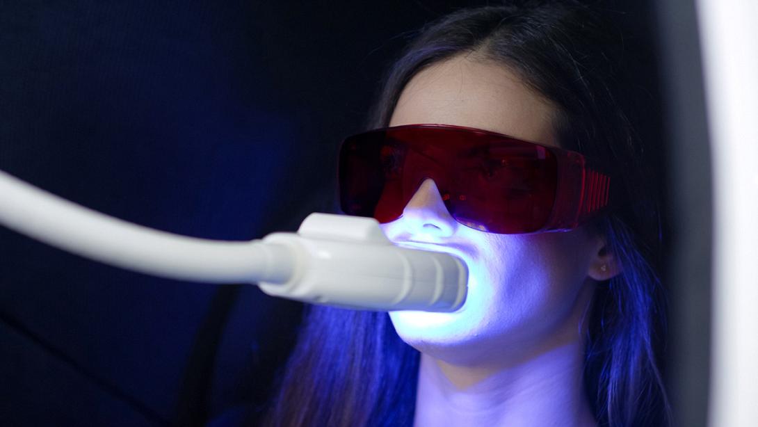 λεύκανση δοντιών