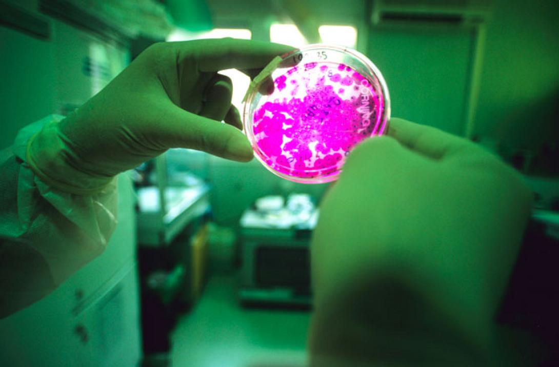 'Εφτιαξαν ανθρώπινο στομάχι με τη βοήθεια βλαστοκυττάρων!