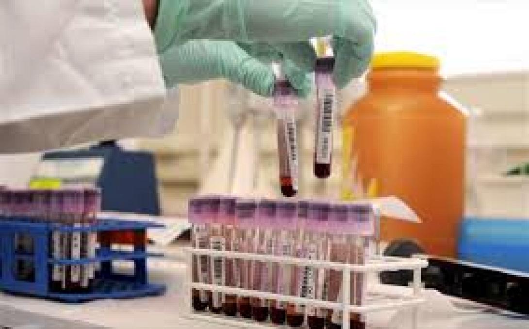 Βρήκαν πανίσχυρο τεστ αντι-ντόπινγκ στην Αμερική