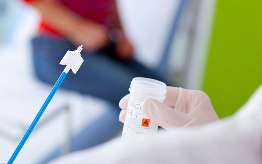 τεστ παπανικολάου