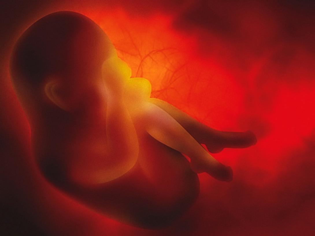 άμβλωση-έμβρυο