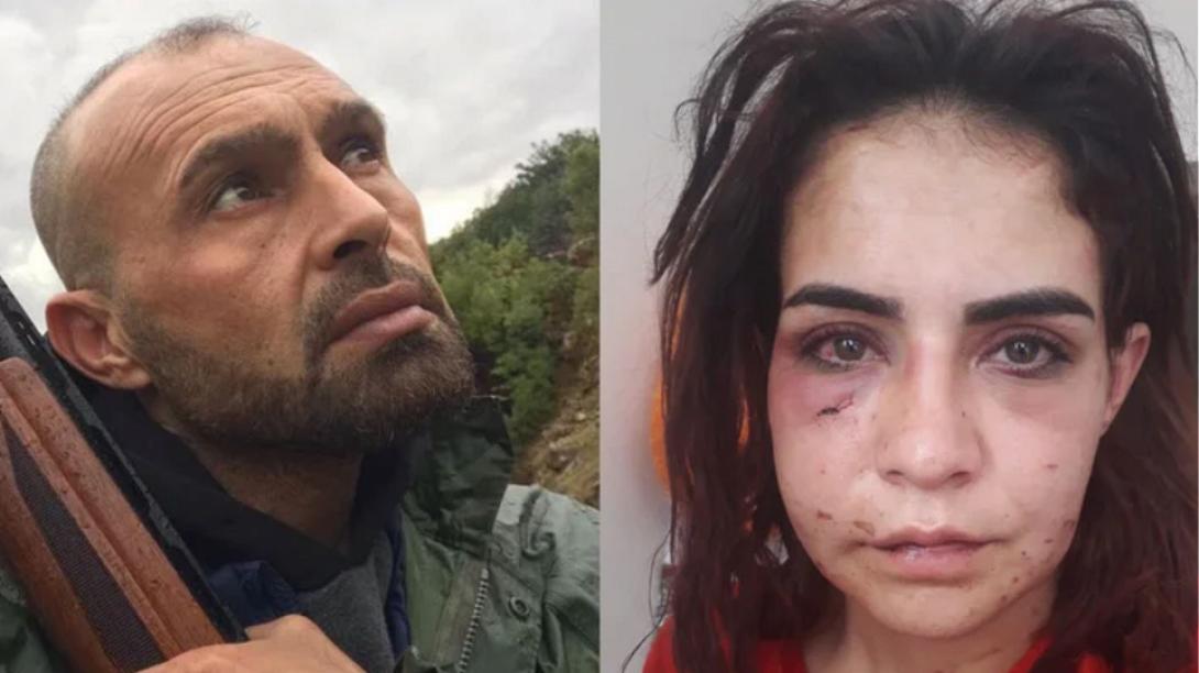 Τούρκος φέρεται να έδειρε μέχρι λιποθυμίας την ερωμένη του σε βιντεοκλήση με τη γυναίκα του