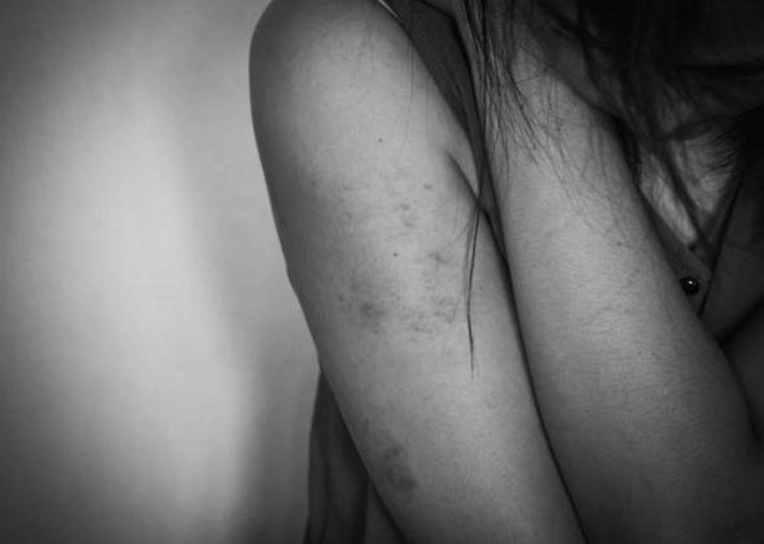 Βία γυναικων