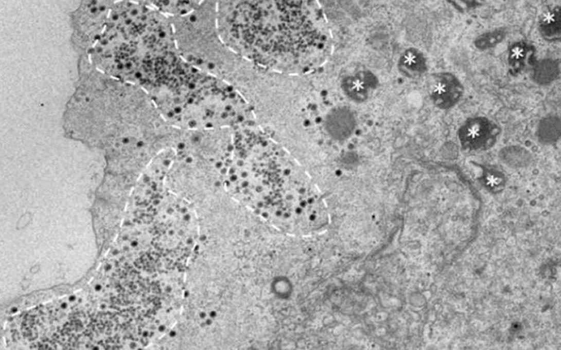 ιός Βραζιλία