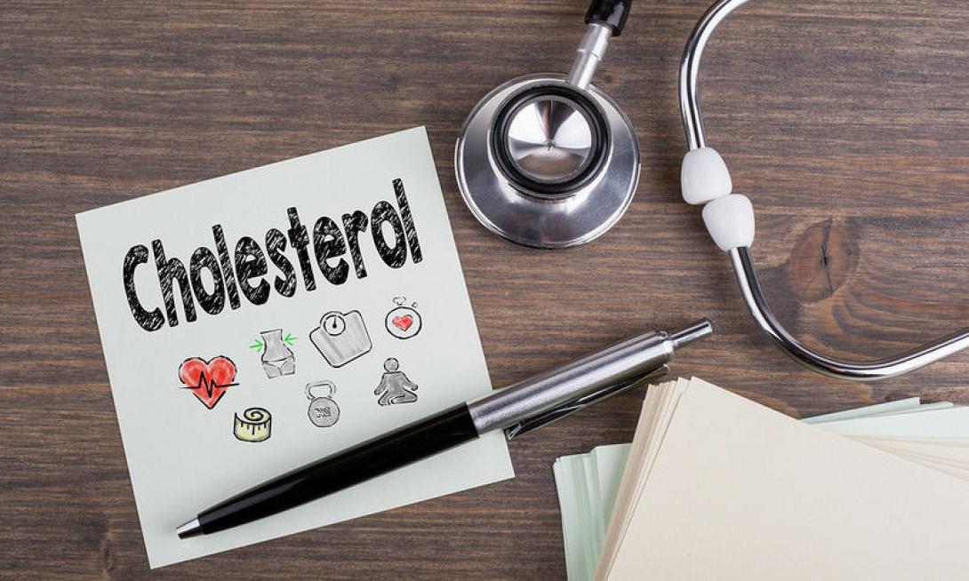 χοληστερίνη