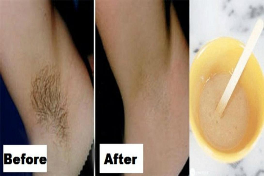 you-only-need-2-ingredients-and-2-minutes-to-get-rid-of-underarm-hair-forever.jpg